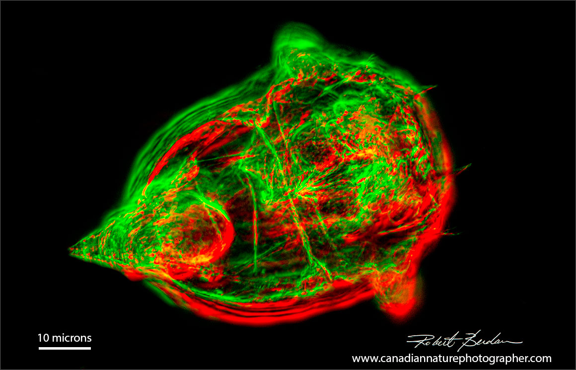 otifer, Synchaeta sp viewed by Rheinberg Lighting and dark-field microscopy by Robert Berdan ©