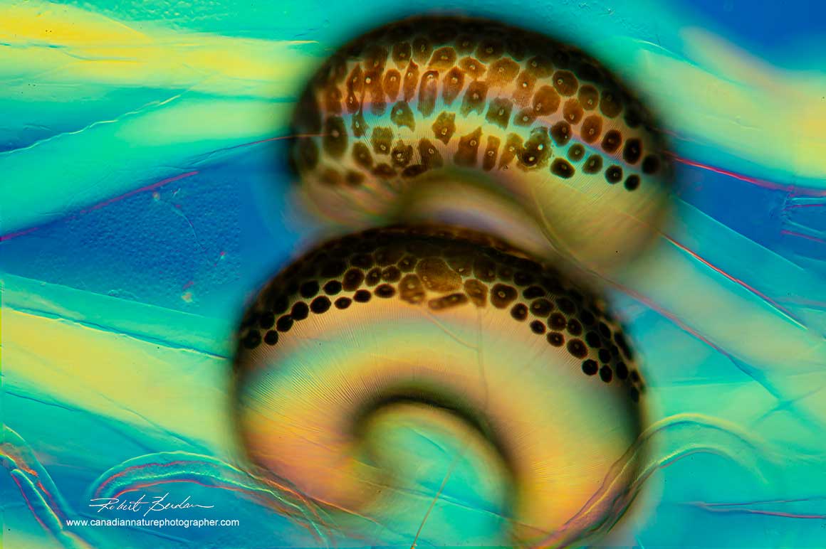 Chaoborus (midge fly larvae) swim bladder 200X DIC microscopy