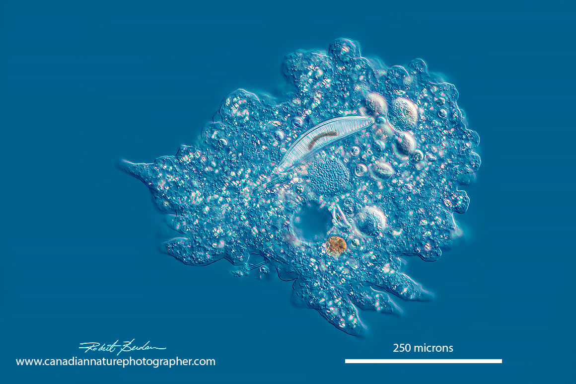 Amoeba proteus by DIC microscopy by Robert Berdan ©