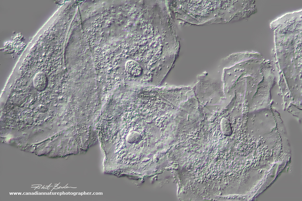 Human inner-cheek epithelial cells DIC microscopy by Robert Berdan ©