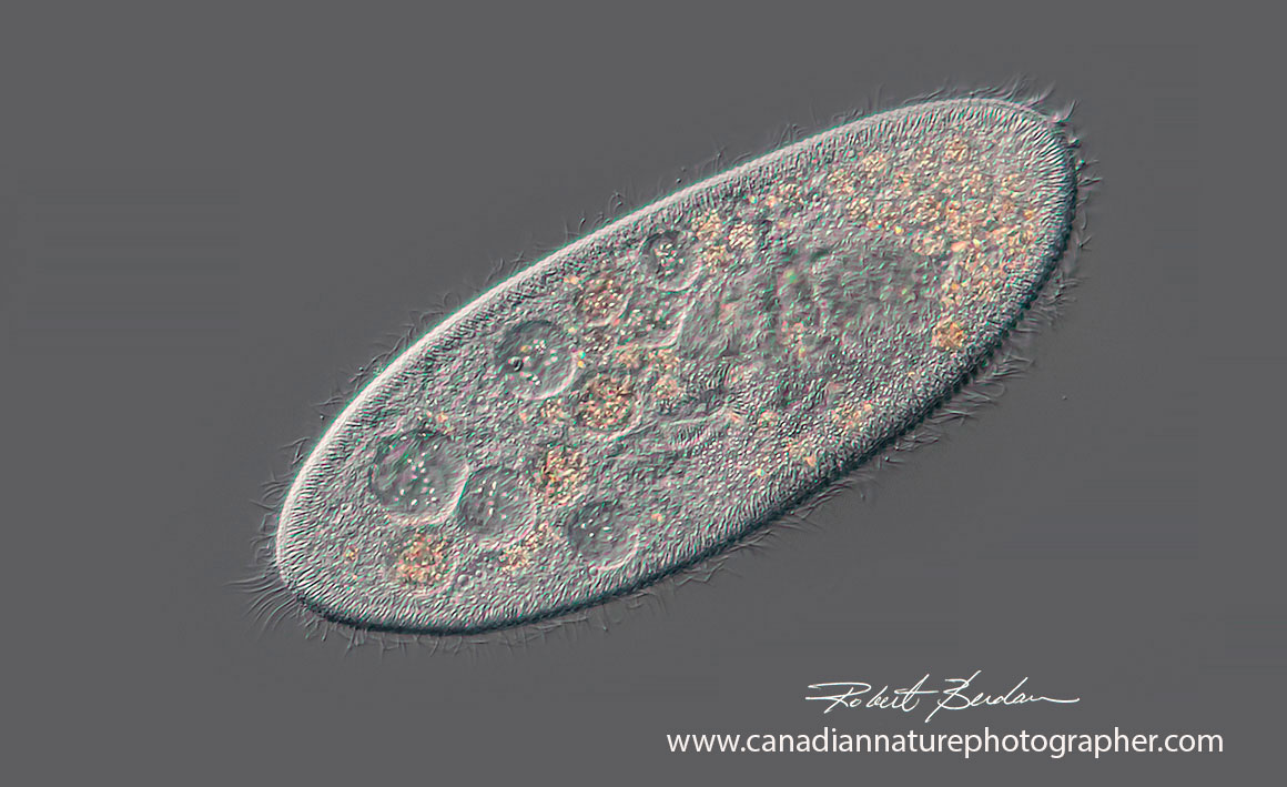 aramecium caudatum by DIC microscopy. 200X by Robert Berdan ©