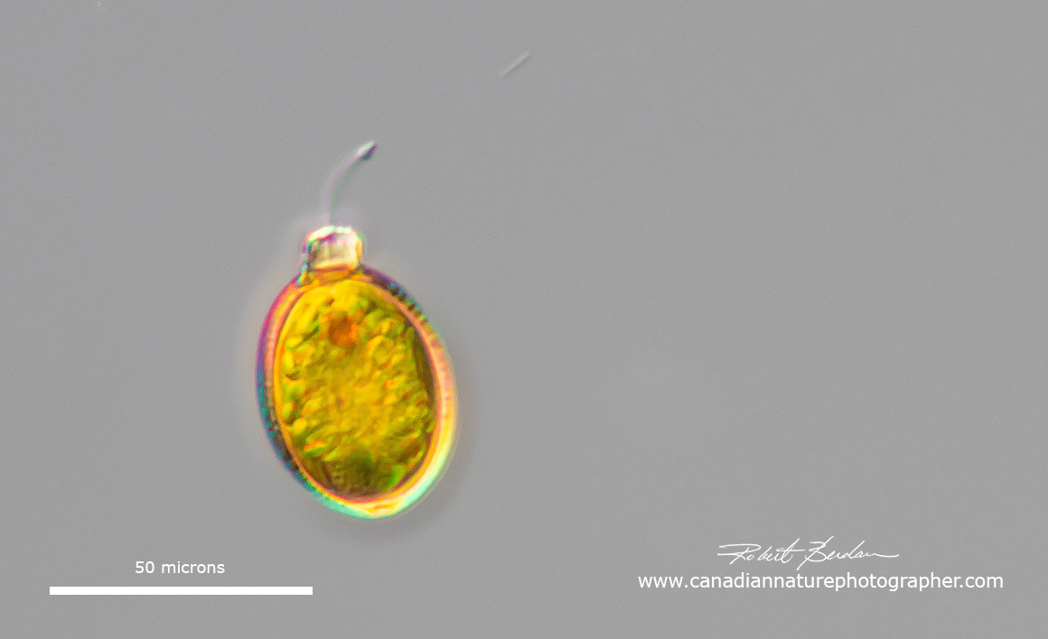 Trachelmonas sp DIC microscopy Robert Berdan ©