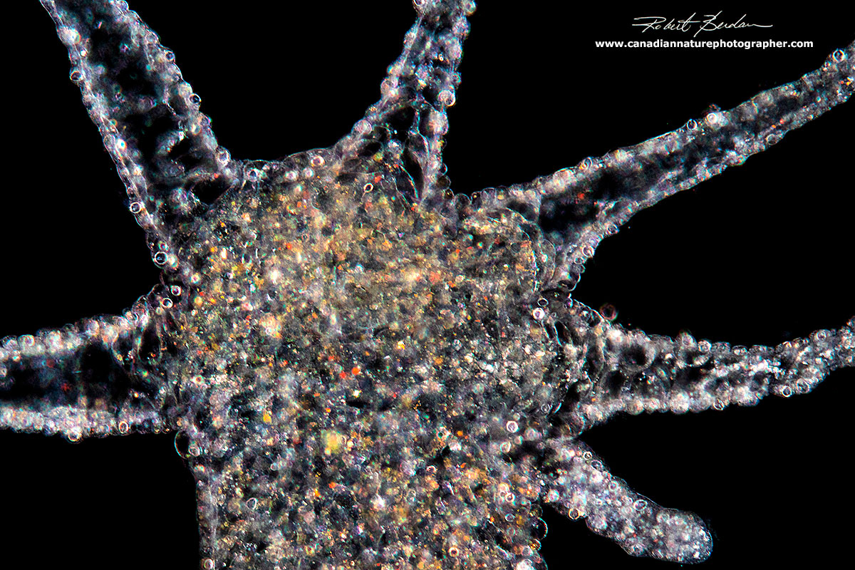 Hydra hydranth via Dark field microscopy by Robert Berdan ©