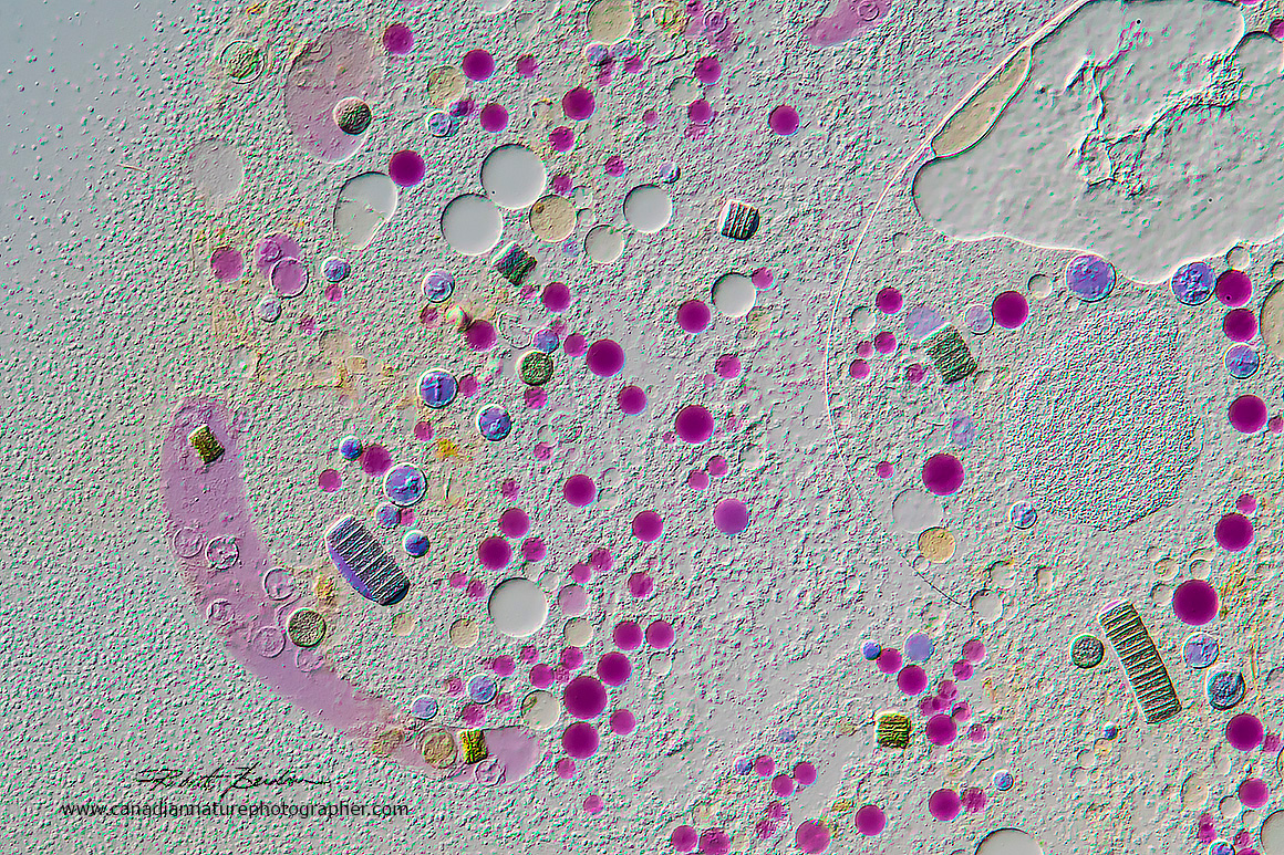 Nassulid Extruded cytoplasm 100X DIC microscopy by Robert Berdan ©