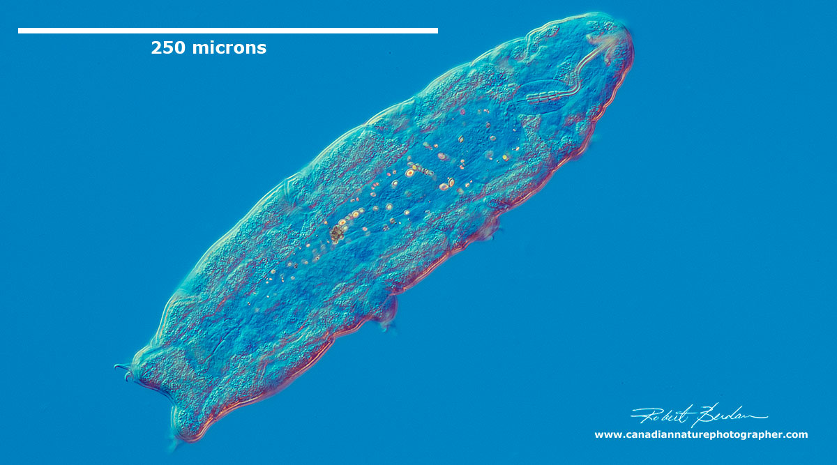 Diphascon species of Tardigrade DIC microscopy by Robert Berdan ©