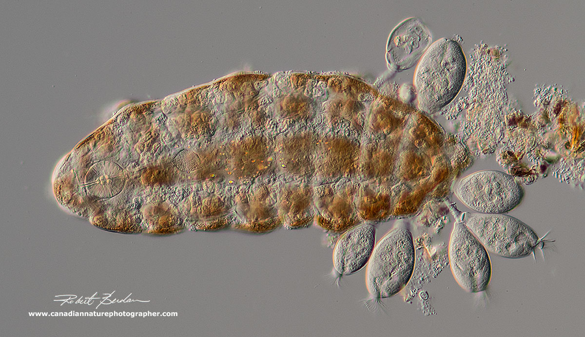 Ramazzottius oberhaeuseri with attached protozoa Pyxidium tardigradum ciliates - parasites by Robert Berdan ©