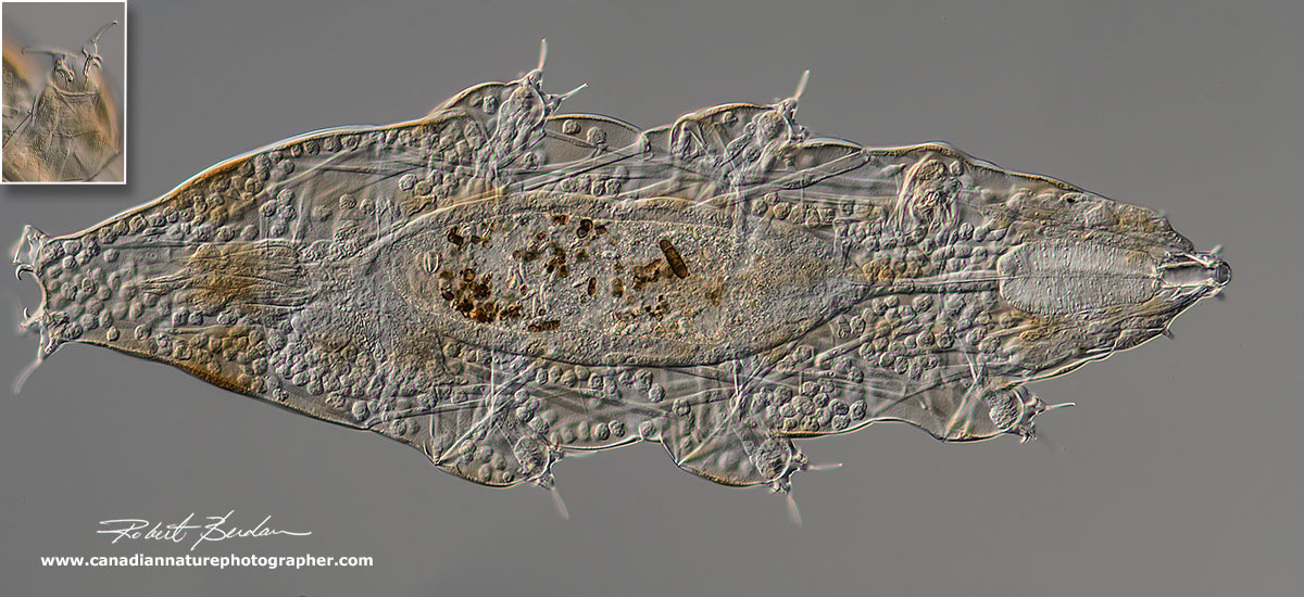 Milenisium tardigradum is a predatory Tardigrade DIC microscopy by Robert Berdan ©