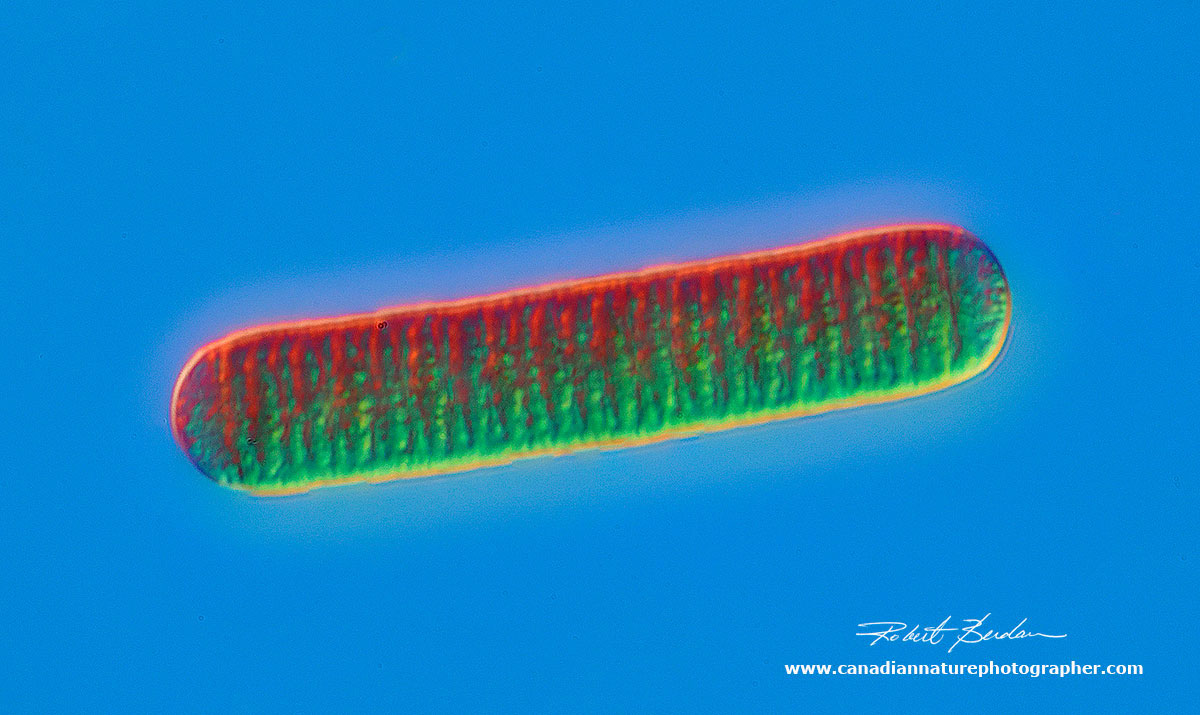 Blue-green algae (Oscillatoria) DIC microscopy. 800X Robert Berdan ©