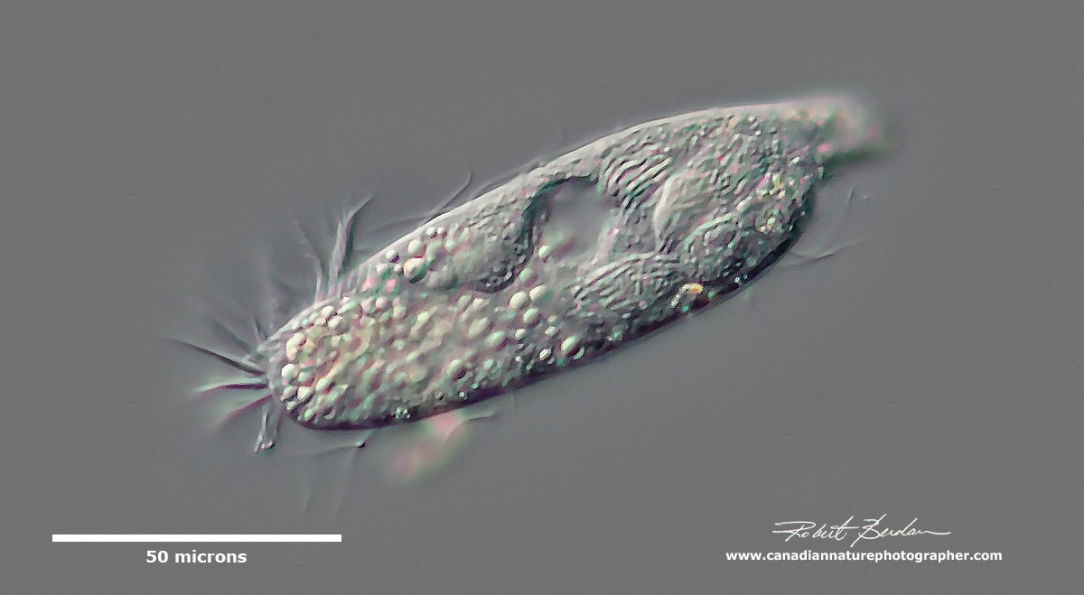 Heterotrich ciliate DIC microscopy by Robert Berdan ©
