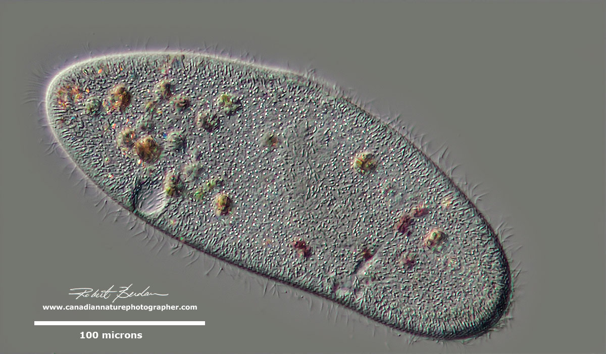 Paramecium caudatum DIC microscopy by Robert Berdan ©