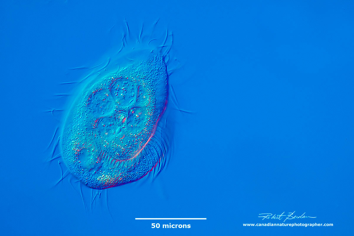 Phacodinium metchnikoffi  a ciliate found in moss by Robert Berdan ©