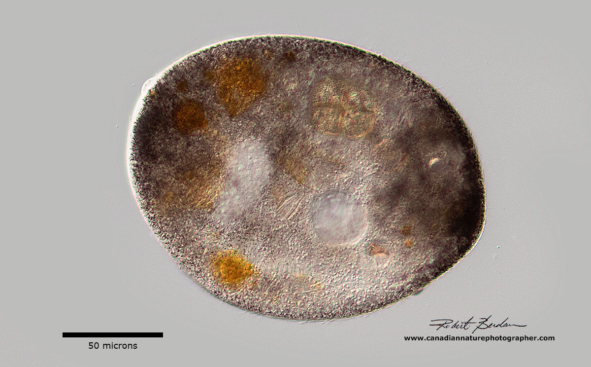 Frontonia atra ciliate by Robert Berdan ©