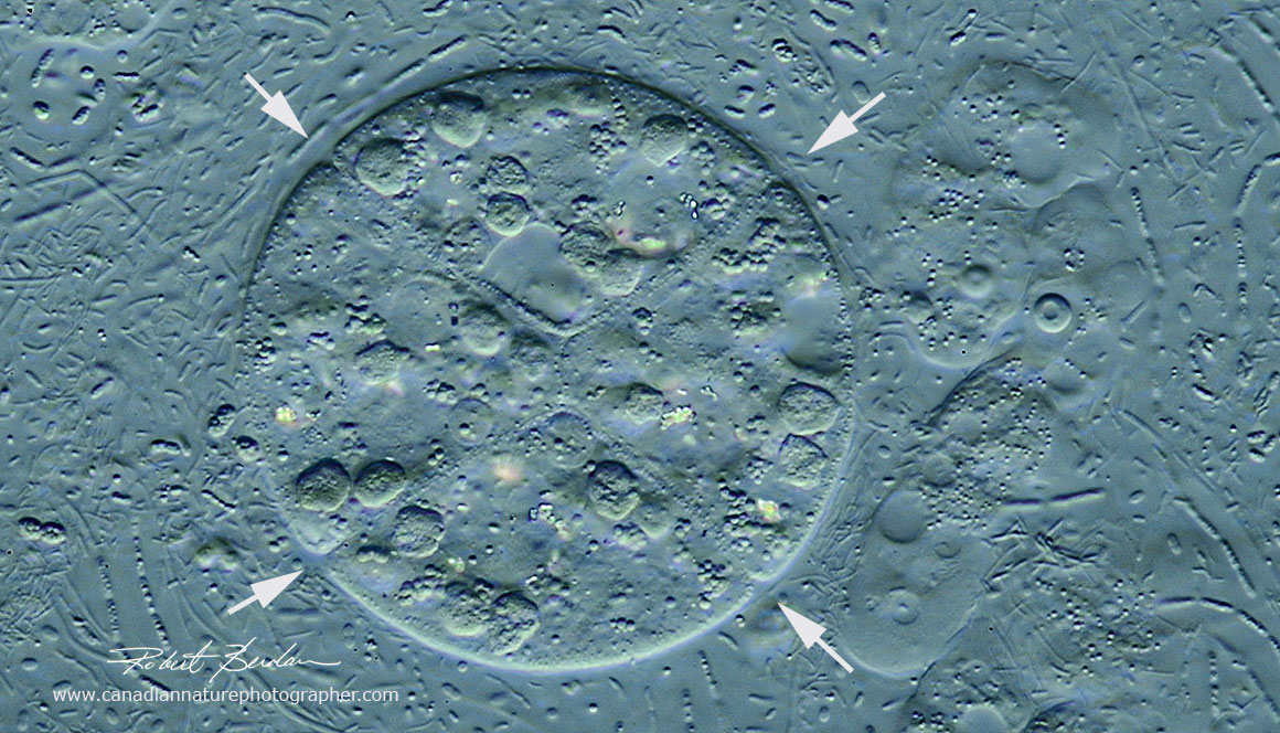 Palintomy in Colpoda ciliates DIC microscopy by Robert Berdan ©