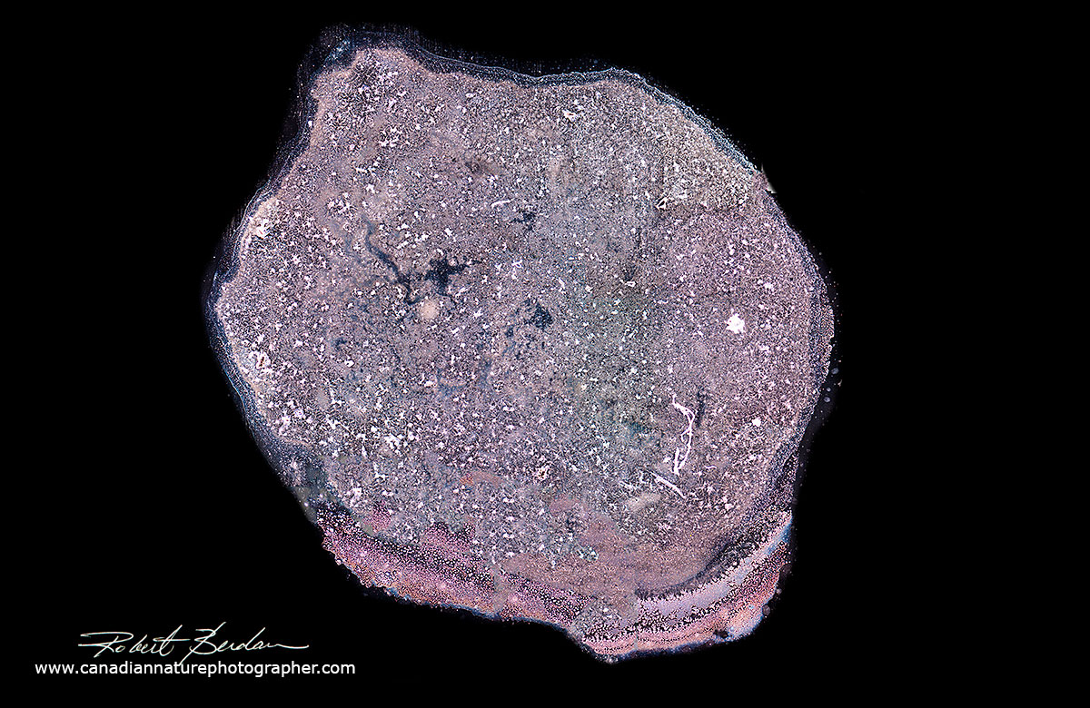 tear drop Darkfield microscopy Robert Berdan ©