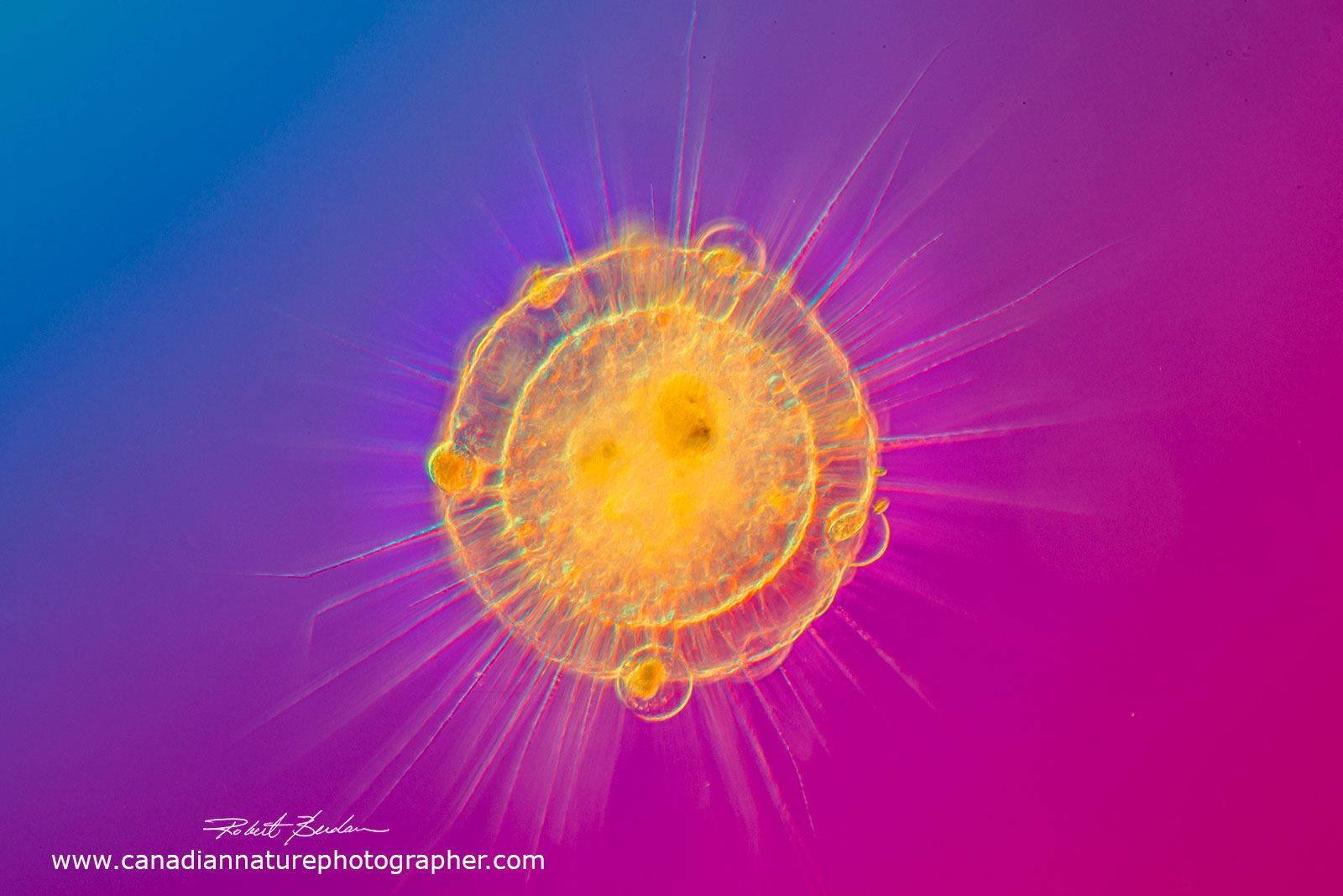 Actinosphaerium is a single celled protist living in pond water related to amoeba. by Robert C. Berdan 