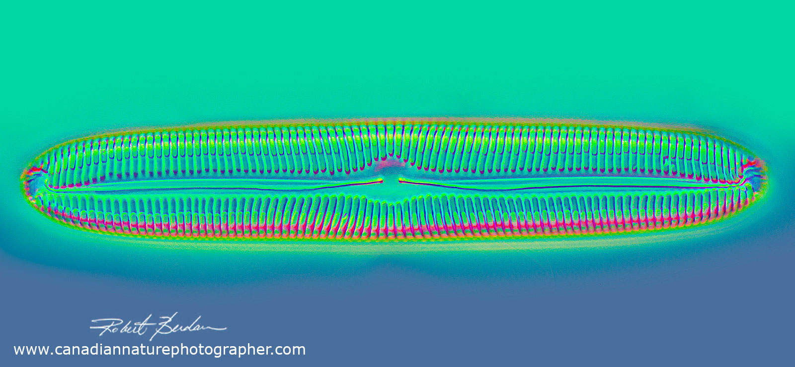 Fresh water diatom shell, Pinnulariasp by DIC microscopy 400X 