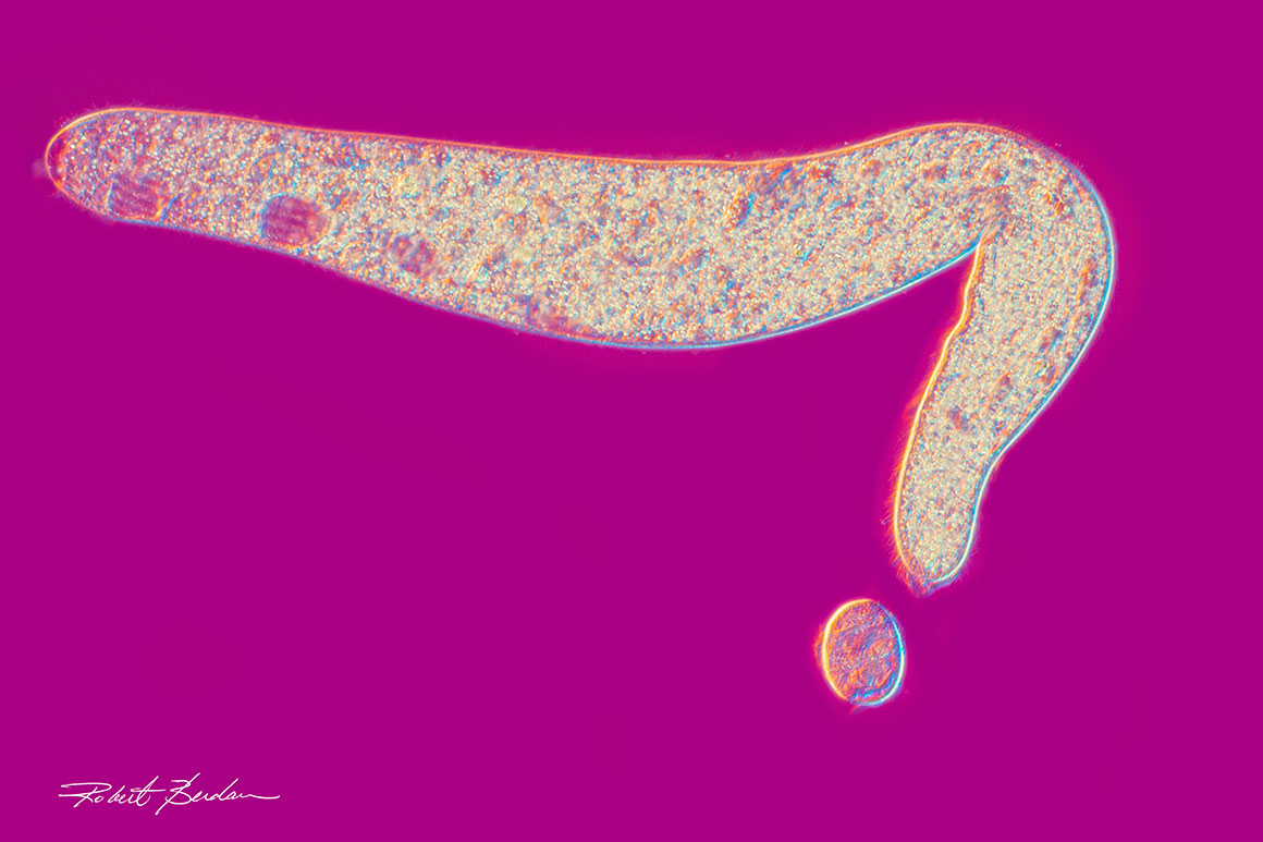 Single celled ciliates Spirostomum minus (top) and Urocentrum turbo (bottom) 100X by Robet C Berdan 