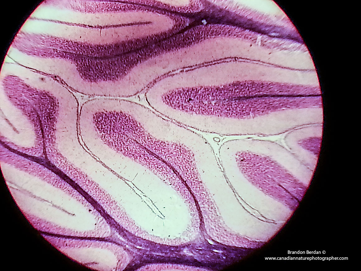 Cerebellum tissue photographed 100X with the Samsung Galaxy III Brandon Berdan ©