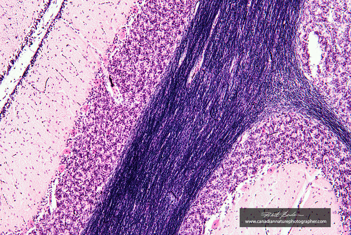 Cerebellum 100X brightfield microscopy Rising Cam Robert Berdan ©