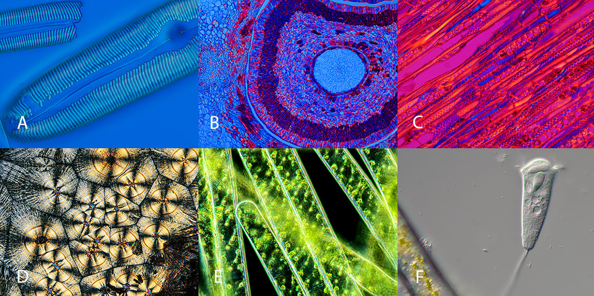 Montage of photomicrographic  images taken with the Rising Camera Robert Berdan ©