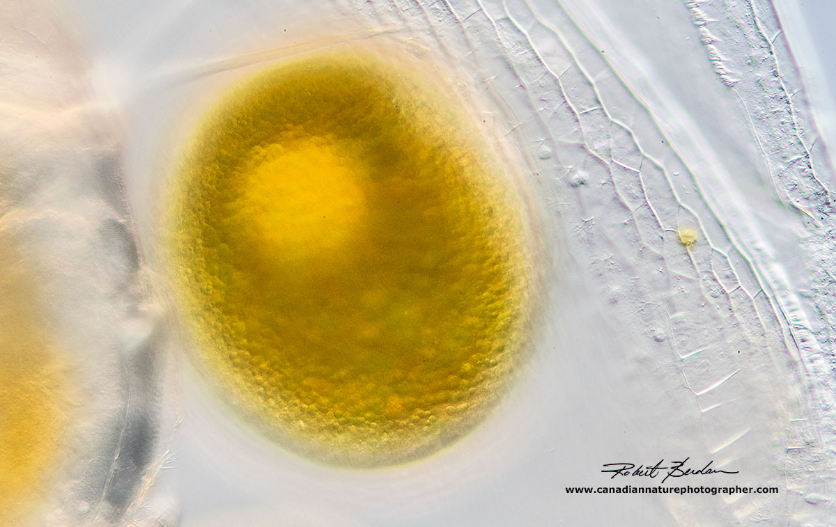 Single egg inside the Daphnia carapace by Robert Berdan ©