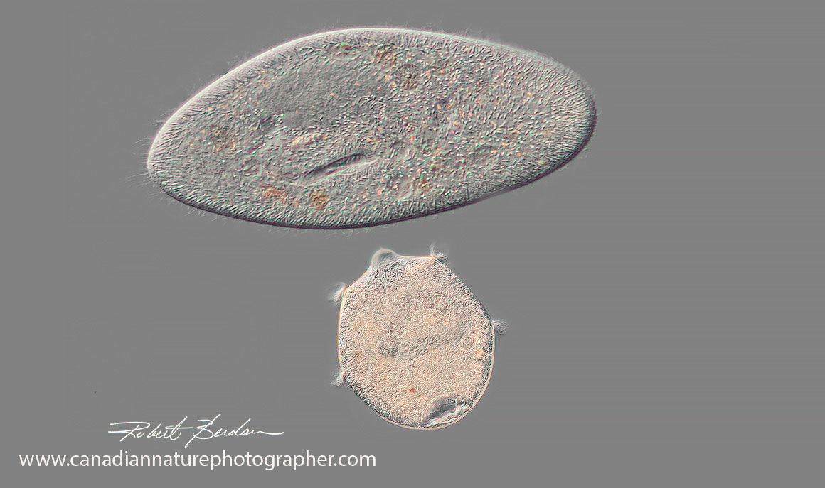 Paramecium and Didinium DIC microscopy by Robert Berdan ©