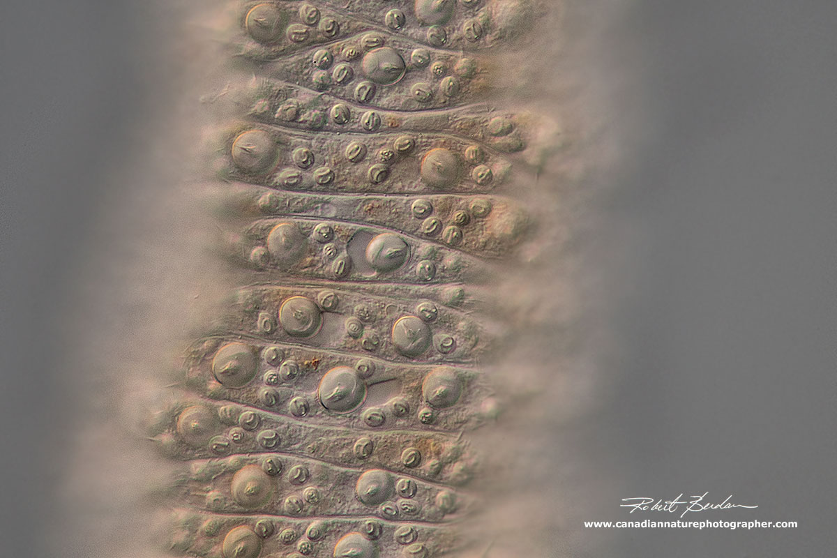 Cnidoblasts cover the Hydra's tentacles. DIC microscopy by Robert Berdan ©