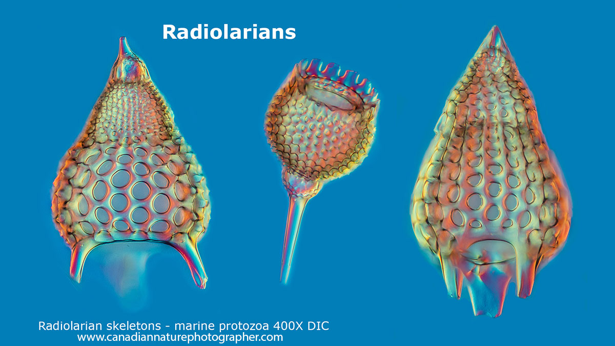 Radiolarians from fossil samples from the Netherlands DIC microscopy Robert Berdan ©