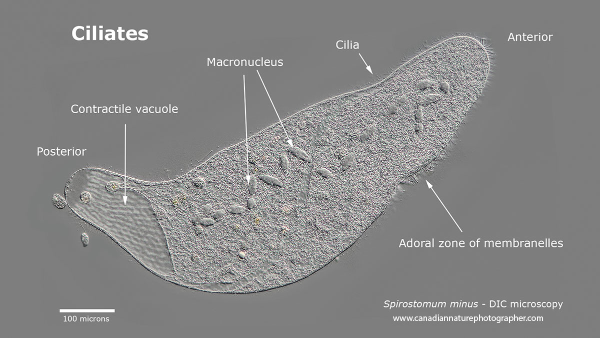 Spirostomum minus is a large common ciliate from pond water DIC microscopy Robert Berdan ©