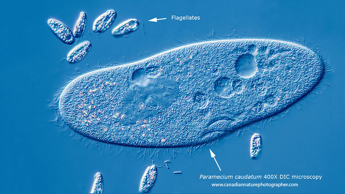 Paramecium caudatum surrounded by smaller flagellates DIC microscopy by Robert Berdan ©
