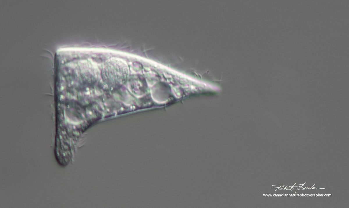 Unusual shaped ciliate I found in pond water. 400X DIC microscopy. Stokesia vernalis Robert Berdan ©