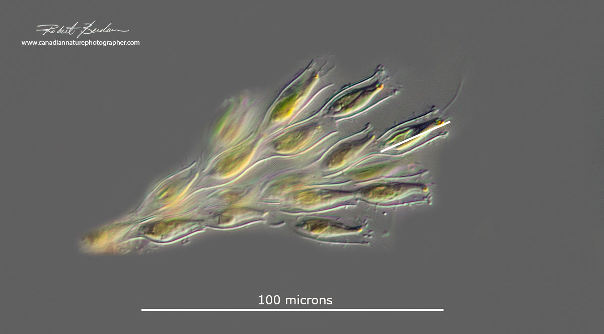 Dinobryon is a form of microscopic algae found in ponds Robert Berdan ©