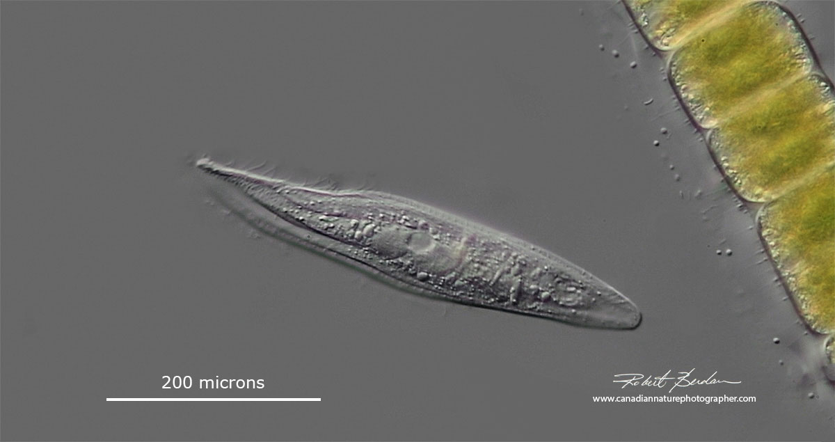Litonotus fasciola ciliate DIC microscopy Robert Berdan ©