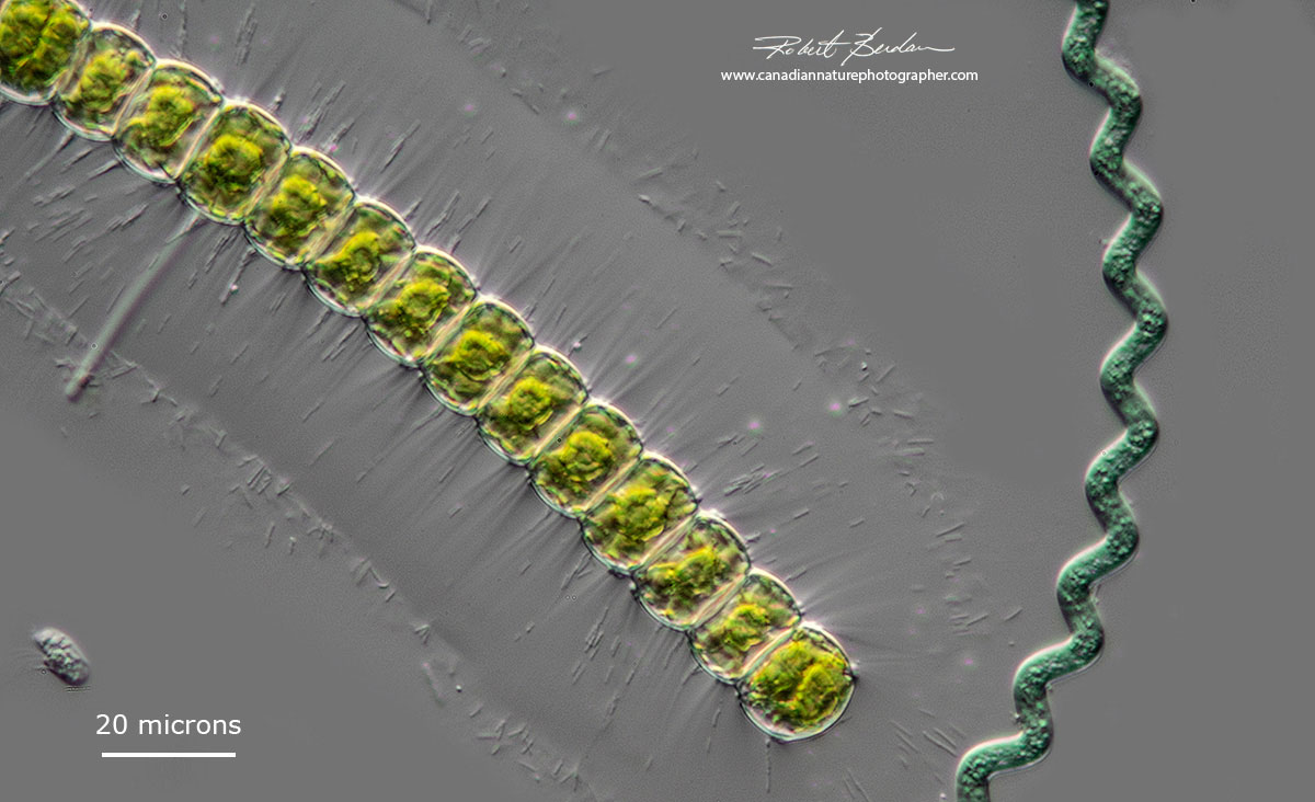 Arthrospira and Hyalotheca DIC microscopy Robert Berdan ©