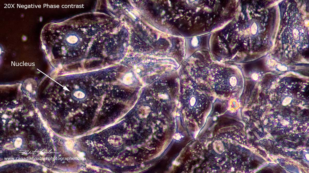 Human cheek cells viewed in Negative Phase contrast by Robert Berdan ©