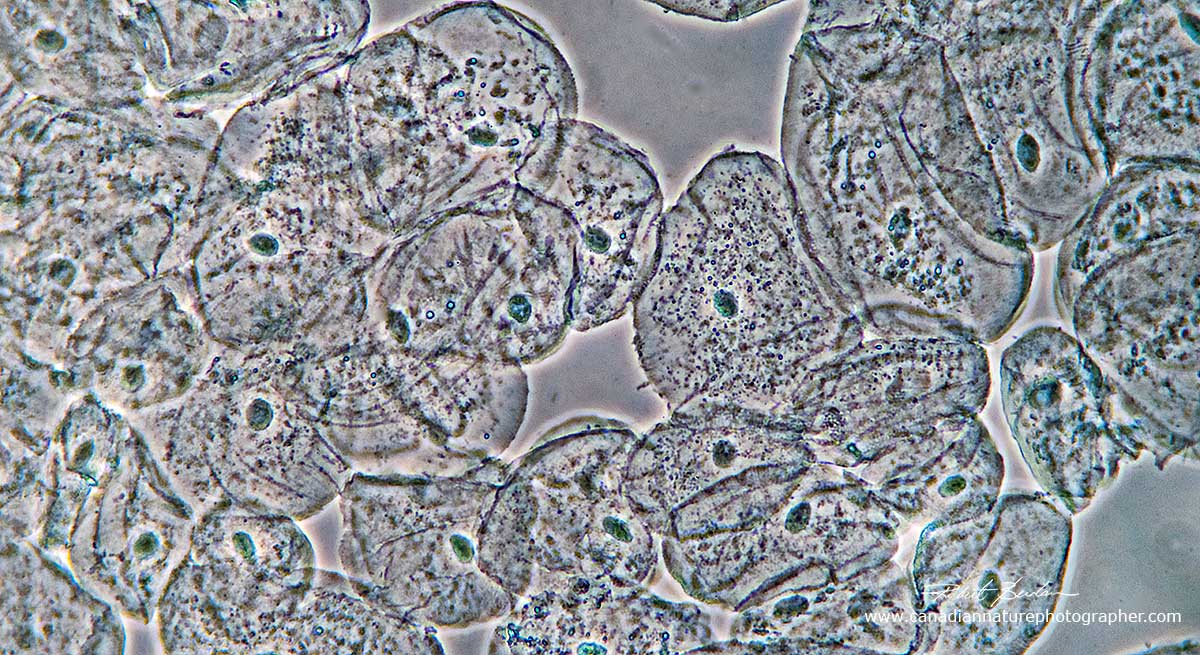 Cheek cells positive phase contrast microscopy by Robert Berdan 