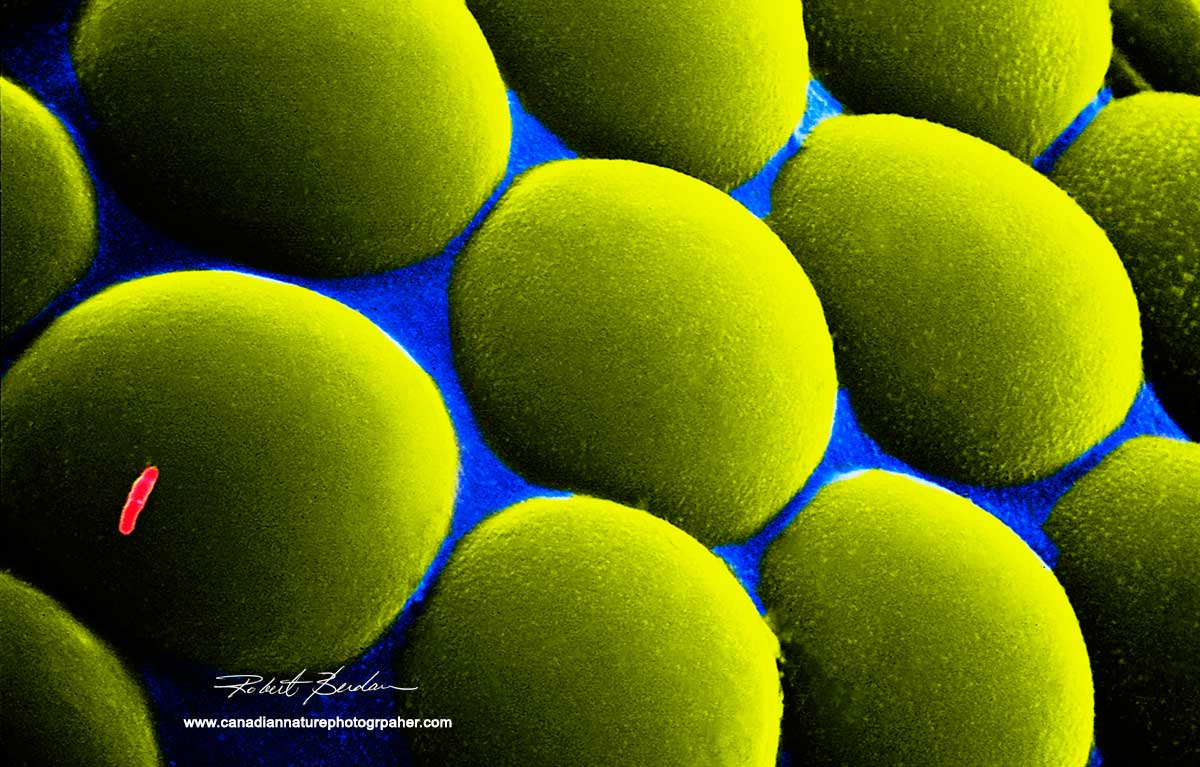 Ommadia in compound eye of Aphid Robert Berdan ©