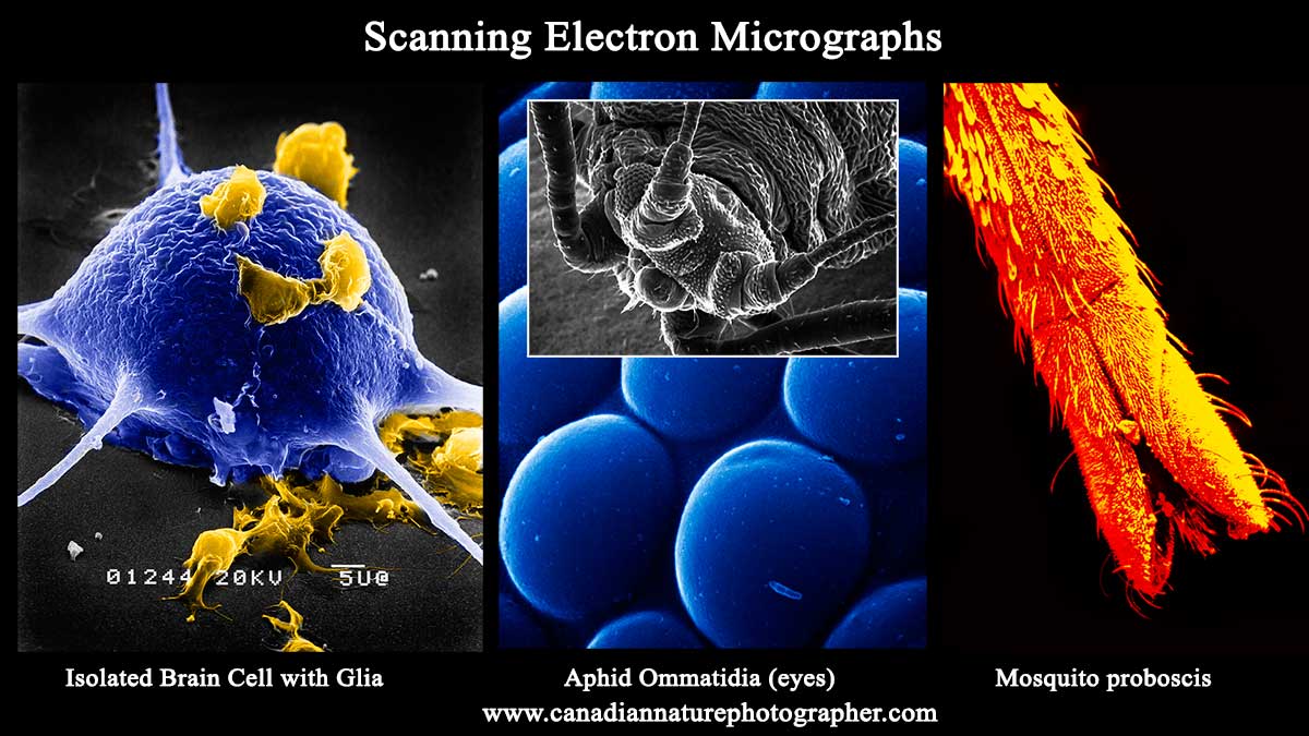 Scanning electron micrographs by Robert Berdan ©