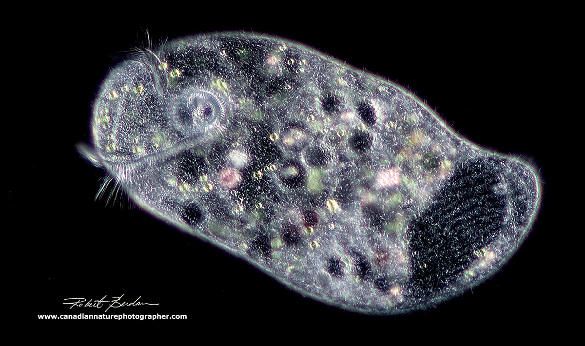Stentor sp viewed by Darkfield microscopy 100X  by Robert Berdan ©