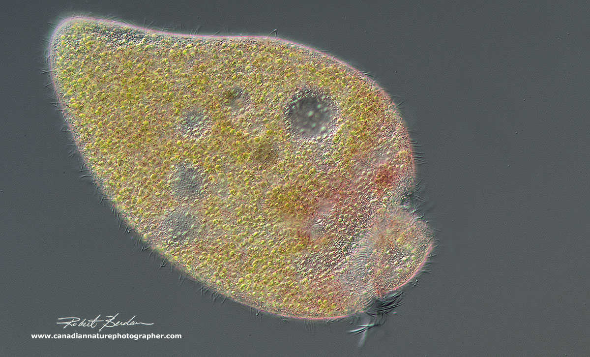 Stentor amethystinus viewed by DIC microscopy 100X by Robert Berdan ©