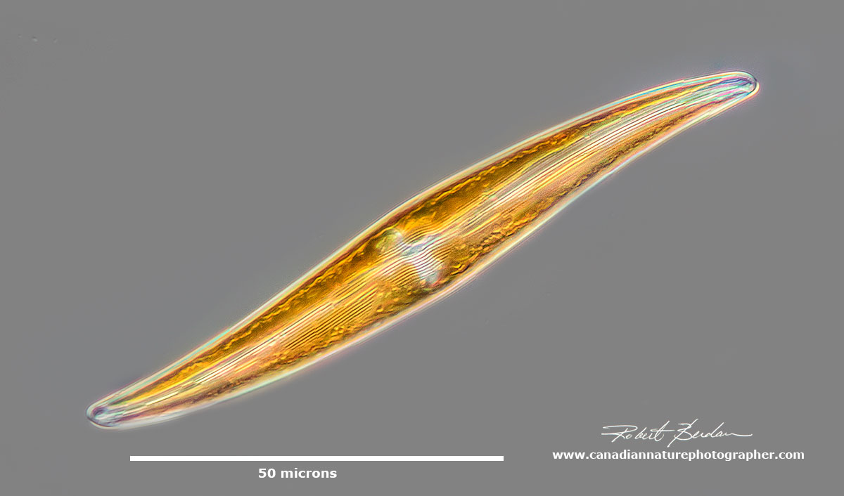 Gyrosigma sp of Diatom has an "S" shape Robert Berdan ©