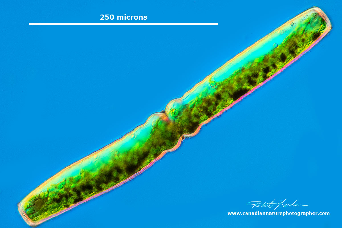 Pleurotaenium sp Desmid DIC microscopy by Robert Berdan ©