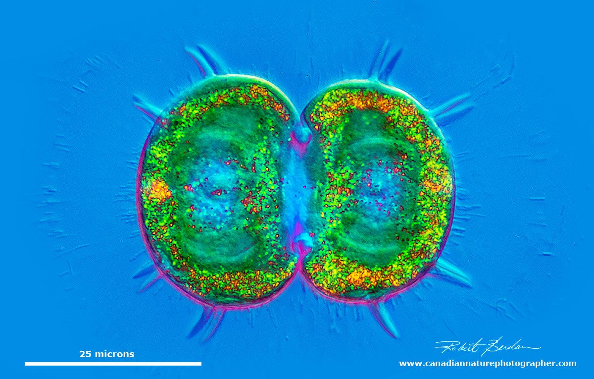 Spinocosmarium sp of desmid - DIC microscopy by Robert Berdan ©