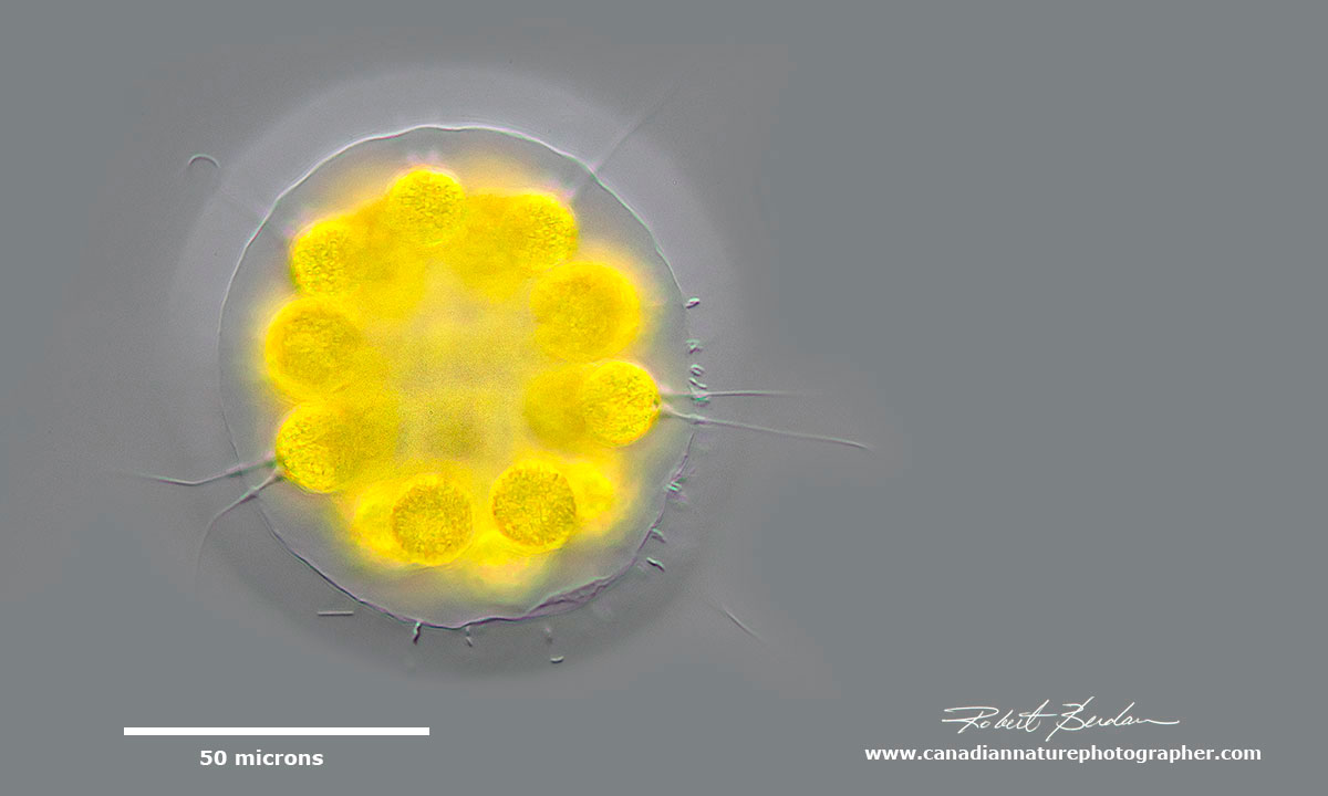 Pandorina or Eudorina 32 cells DIC microscopy by Robert Berdan ©