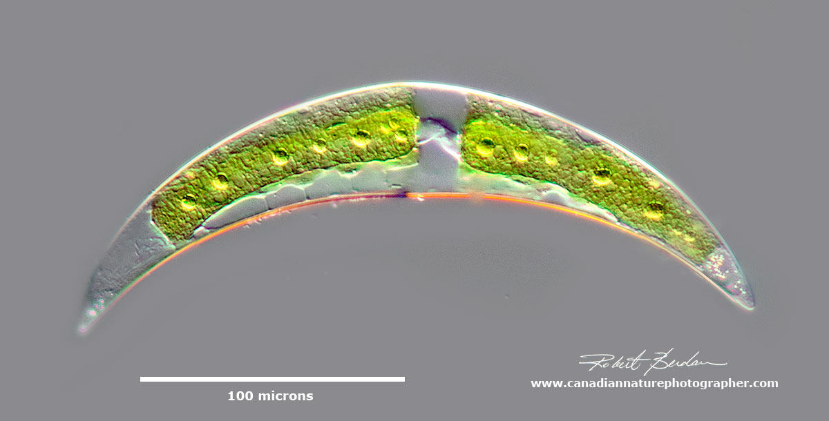 Closterium sp of Desmid Focus Stack DIC microscopy by Robert Berdan ©