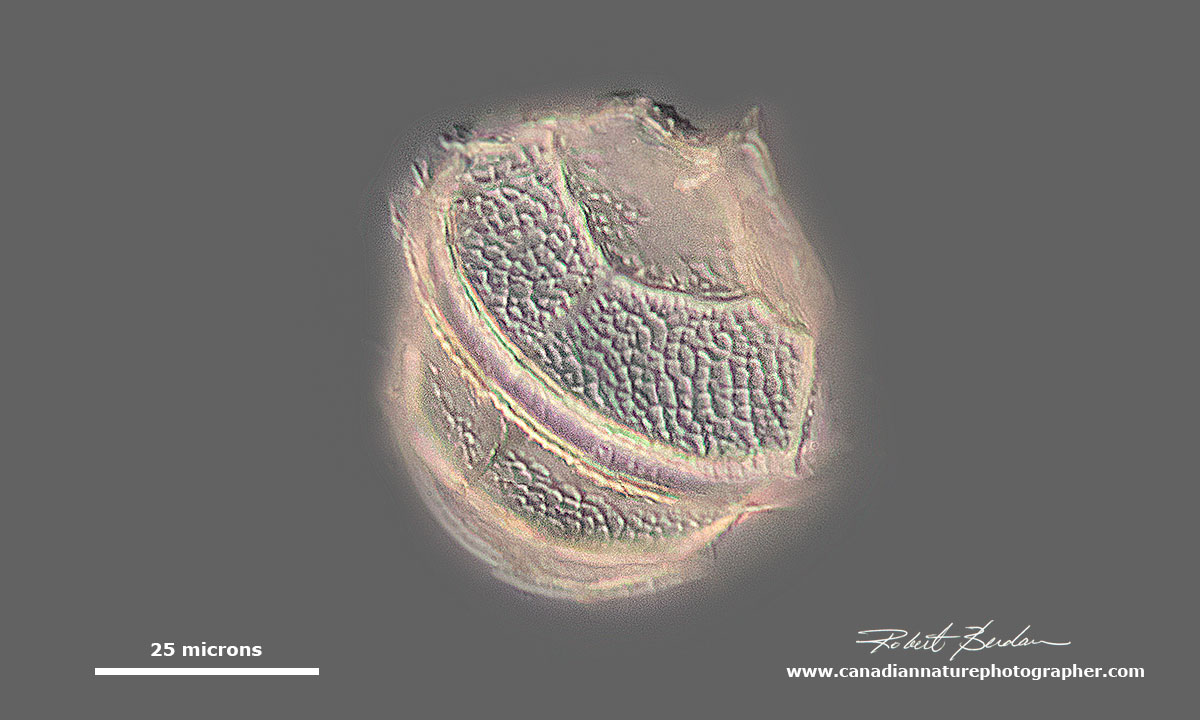 Dinoflagellate DIC microscopy Gonyaulax sp by Robert Berdan ©
