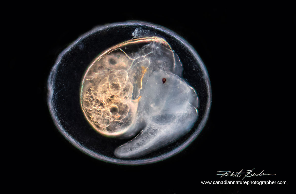 Fresh water snail in egg Darkfield microscopy Robert Berdan ©