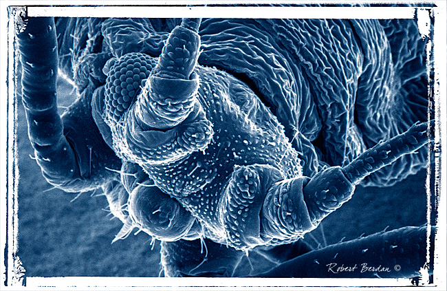 Aphid scanning electron micrograph by Robert Berdan ©