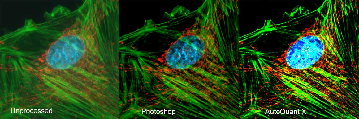 Mamalian cells in culture comparing unprocess, Photoshop processed and AutoQuant X