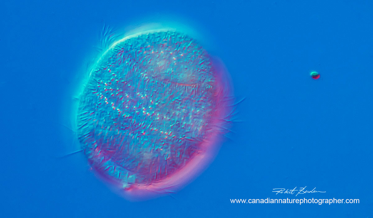 Ciliate, Family Parameciidae possibly Uroncentrum turbo 400X DIC microscopy by Robert Berdan ©